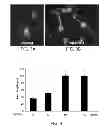 Fig. 04 - Methods for promoting neuronal outgrowth by insulin-like growth factor binding protein-like 1 (IGFBPL-1) in glaucoma or leber's optic neuropathy