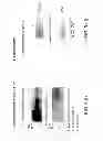 Fig. 05 - Methods for promoting neuronal outgrowth by insulin-like growth factor binding protein-like 1 (IGFBPL-1) in glaucoma or leber's optic neuropathy