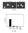 Fig. 06 - Methods for promoting neuronal outgrowth by insulin-like growth factor binding protein-like 1 (IGFBPL-1) in glaucoma or leber's optic neuropathy