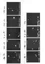 Fig. 07 - Methods for promoting neuronal outgrowth by insulin-like growth factor binding protein-like 1 (IGFBPL-1) in glaucoma or leber's optic neuropathy