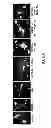 Fig. 09 - Methods for promoting neuronal outgrowth by insulin-like growth factor binding protein-like 1 (IGFBPL-1) in glaucoma or leber's optic neuropathy