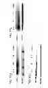 Fig. 12 - Methods for promoting neuronal outgrowth by insulin-like growth factor binding protein-like 1 (IGFBPL-1) in glaucoma or leber's optic neuropathy