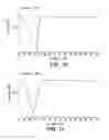 Fig. 04 - Solid Solution Compositions and Use in Cardiovascular Disease
