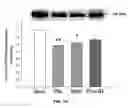 Fig. 16 - Na/K-ATPase ligand