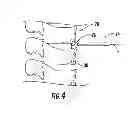 Fig. 03 - Shape memory curable spinal implants