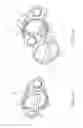 Fig. 08 - Pelvic implant with suspending system
