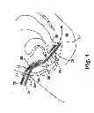 Fig. 04 - Adjustable tension incontinence sling assemblies