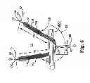 Fig. 05 - Adjustable tension incontinence sling assemblies