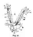 Fig. 11 - Adjustable tension incontinence sling assemblies