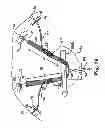 Fig. 15 - Adjustable tension incontinence sling assemblies