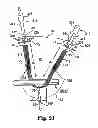 Fig. 16 - Adjustable tension incontinence sling assemblies