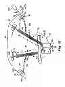 Fig. 17 - Adjustable tension incontinence sling assemblies