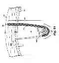 Fig. 19 - Adjustable tension incontinence sling assemblies