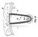 Fig. 20 - Adjustable tension incontinence sling assemblies