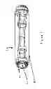 Fig. 03 - Apparatus and method for inhibiting stress urinary incontinence