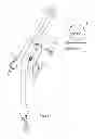 Fig. 04 - Endobronchial tube with integrated image sensor and a cleaning nozzle arrangement