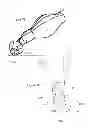 Fig. 07 - Endobronchial tube with integrated image sensor and a cleaning nozzle arrangement