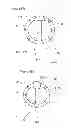Fig. 11 - Endobronchial tube with integrated image sensor and a cleaning nozzle arrangement