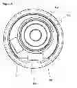 Fig. 12 - Endobronchial tube with integrated image sensor and a cleaning nozzle arrangement