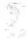 Fig. 13 - Endobronchial tube with integrated image sensor and a cleaning nozzle arrangement