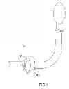 Fig. 02 - Enema and Coloscopy Aide
