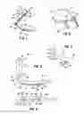 Fig. 02 - INTUBATION GUIDE ASSEMBLY