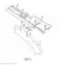 Fig. 04 - Sternal retractor