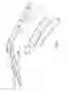 Fig. 05 - Sternal retractor