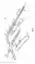 Fig. 09 - Sternal retractor
