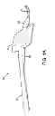Fig. 02 - Surgical retractor for wrist procedures