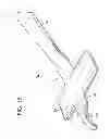 Fig. 03 - Surgical retractor for wrist procedures