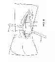 Fig. 08 - Surgical retractor for wrist procedures