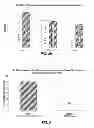 Fig. 03 - Methods for preventing and treating motor related neurological conditions