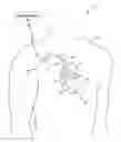 Fig. 01 - Detecting worsening heart failure based on fluid accumulation with respiratory confirmatoin