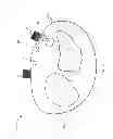 Fig. 03 - Wearable device structure with enhanced motion detection by motion sensor