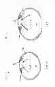 Fig. 04 - Wearable device structure with enhanced motion detection by motion sensor