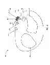 Fig. 05 - Wearable device structure with enhanced motion detection by motion sensor
