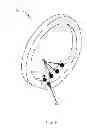 Fig. 07 - Wearable device structure with enhanced motion detection by motion sensor