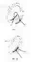 Fig. 09 - Wearable device structure with enhanced motion detection by motion sensor