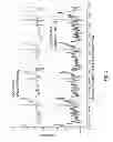 Fig. 02 - Electrocardiogram signal detection