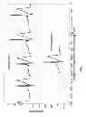 Fig. 08 - Electrocardiogram signal detection