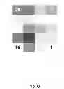 Fig. 07 - Seizure detection and epileptogenic lesion localization