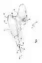 Fig. 02 - Tissue excision device with an independent needle