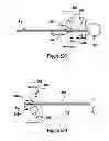 Fig. 32 - Tissue excision device with an independent needle