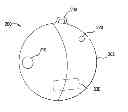 Fig. 01 - MEDICAL DEVICE FOR REMOVING PATHOGENS