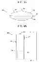 Fig. 05 - MEDICAL DEVICE FOR REMOVING PATHOGENS