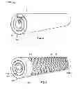 Fig. 03 - Massage Roller