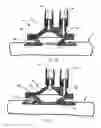 Fig. 07 - HEMODIALYSIS ACCESS PORT AND CLEANING SYSTEM