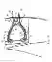 Fig. 09 - HEMODIALYSIS ACCESS PORT AND CLEANING SYSTEM