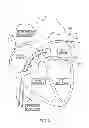 Fig. 03 - METHODS AND APPARATUS FOR REDUCING LOCALIZED CIRCULATORY SYSTEM PRESSURE